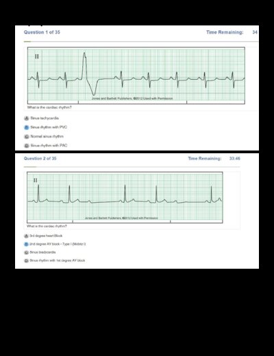 Relias Dysrhythmia Basic Exam Updated Answers 2026